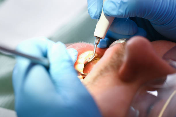 Best Emergency Gum Treatment in Thunderbolt, GA